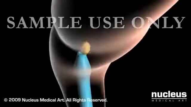 Barium Enema смотреть онлайн