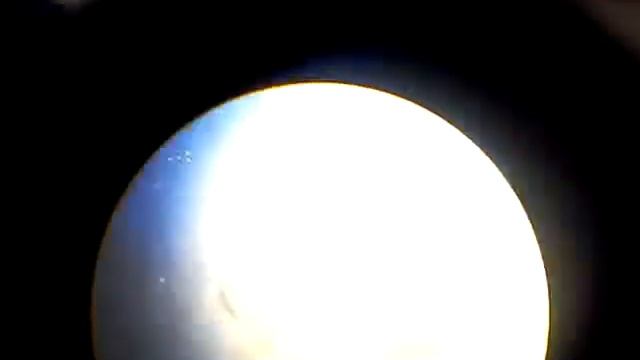 Larvas de Strongyloides stercoralis, en Solución Salina смотреть онлайн