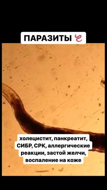 У тебя точно не задержатся паразиты, если ты пройдешь курс безопасной анти паразитарной программы👇👇 смотреть онлайн