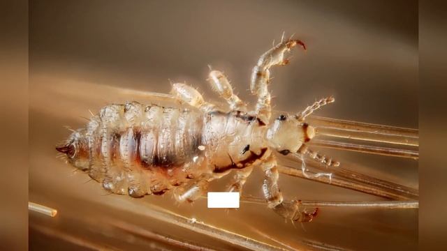 The most DANGEROUS and DEADLY Insects in the World. смотреть онлайн