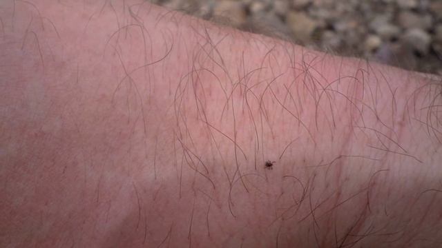 Sheep Ticks смотреть онлайн