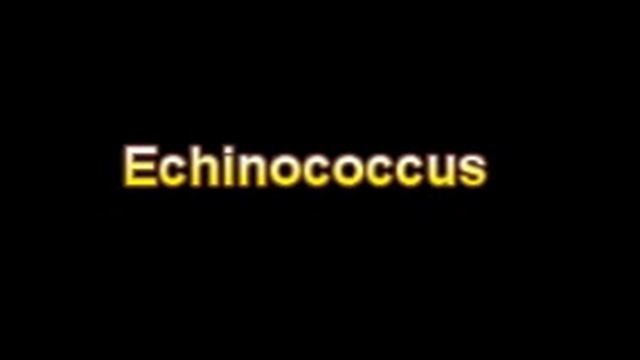 What Is The Definition Of Echinococcus - Medical Dictionary Free Online смотреть онлайн
