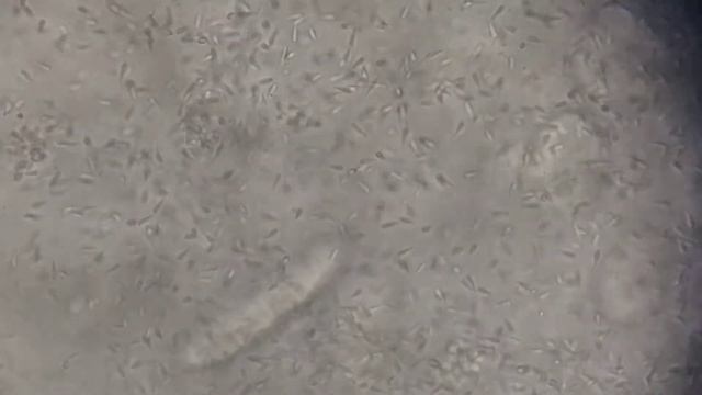 Polychaete farming -Tube worm смотреть онлайн