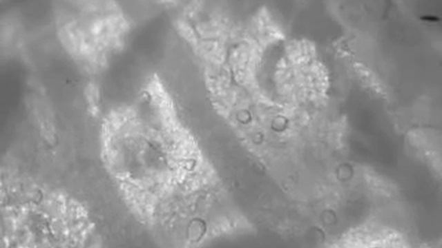 Mucus secretion by single submucosal gland смотреть онлайн