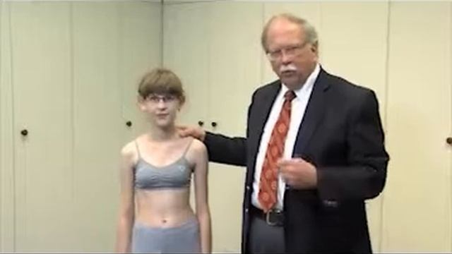 SRS Patient Video: Diagnosing Scoliosis - John R. Dimar II, MD