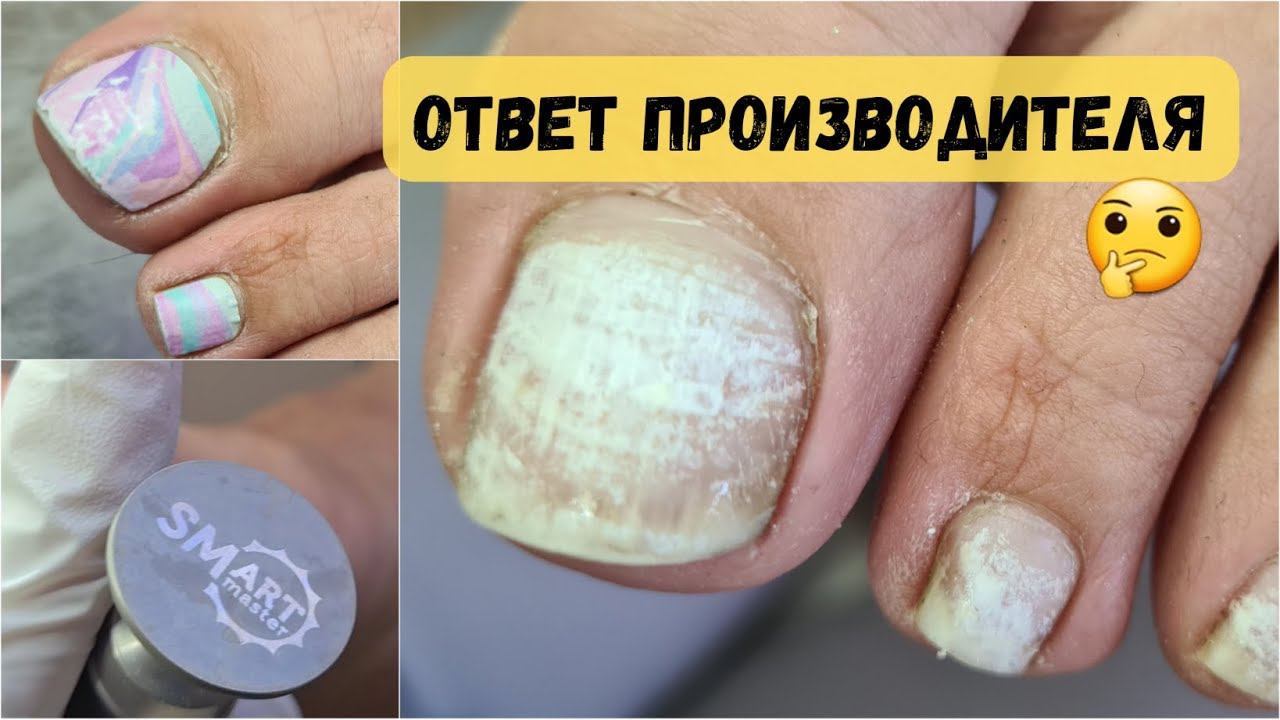 Что с ногтями после пленок? Пришлось отказать! Аппаратный педикюр. смотреть онлайн