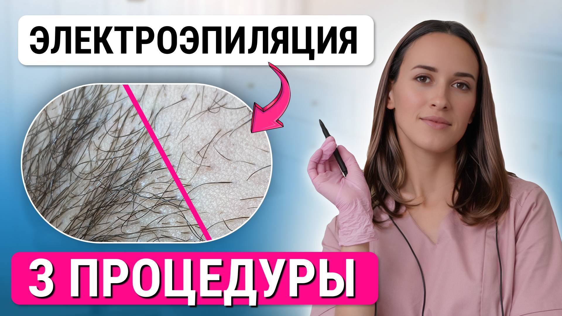 Как УСКОРИТЬ курс процедур электроэпиляции и быстро удалить волосы? смотреть онлайн