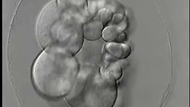 Beroe embryogenesis смотреть онлайн