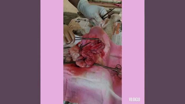 Rectal prolapse смотреть онлайн