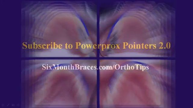 Powerprox Pointers 2.0: 3 Ways To Make Space for Crowded Teeth Part 1 смотреть онлайн