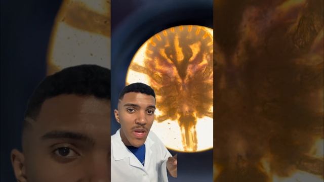 CARRAPATO - ESTRELA (Amblyomma cajennense) / FEBRE MACULOSA смотреть онлайн