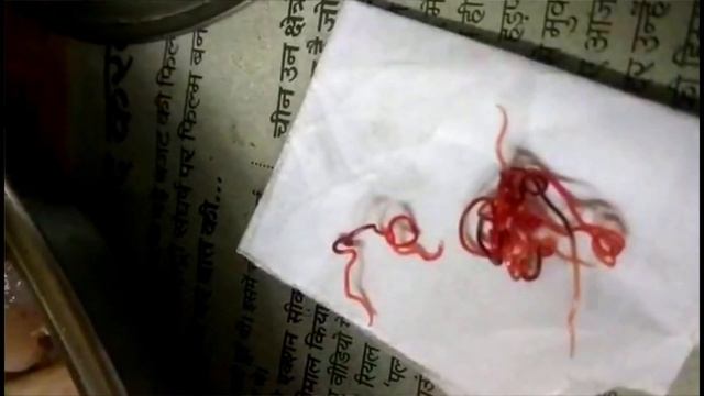 Fish parasites| कीड़ा IN FISH|ROUND WORM IN FISH| HELMINTH PARASITE OF FISH|BEWARE OF PARASITE(2020 смотреть онлайн