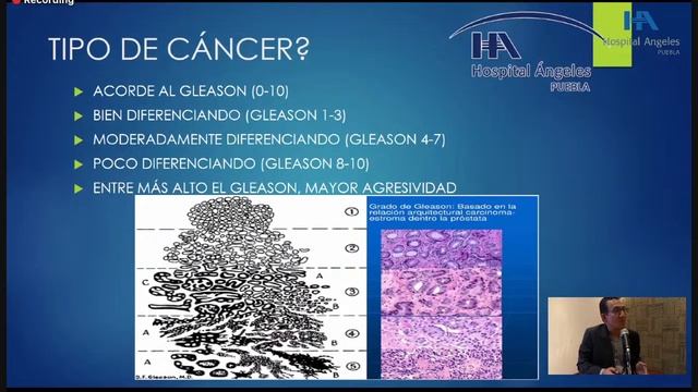 SESIÓN GENERAL “CÁNCER DE PRÓSTATA” смотреть онлайн