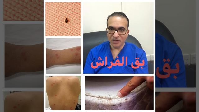 بق الفراش وطرق التخلص منه смотреть онлайн