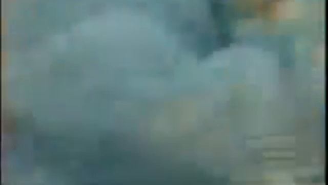 Абдоминопластика смотреть онлайн