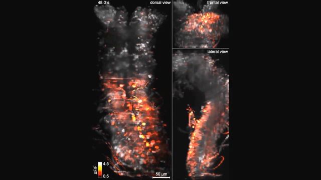 Whole-central nervous system functional imaging in larval Drosophila смотреть онлайн