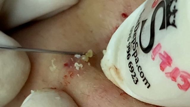 Relax Every Day SacDepSpa #582 (Nam P1) смотреть онлайн