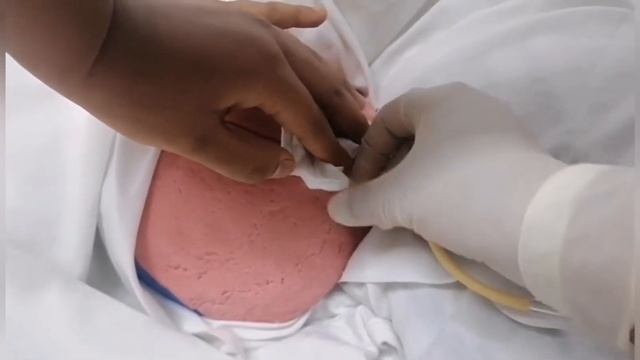 Técnicas de colocación de enemas y tipos de enema GRUPO 3 смотреть онлайн