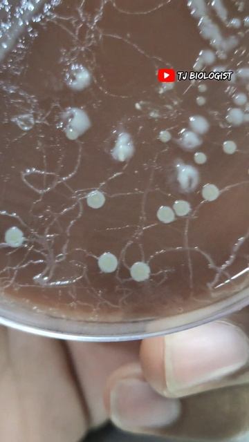 #tjbiologist #science #parasite #animal #trendingshorts #moyemoye #biology #kallakurichi #worms смотреть онлайн