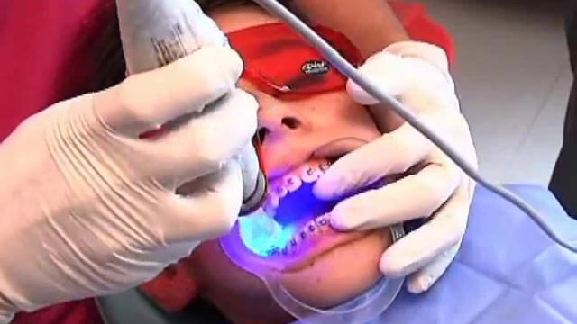 ADVANSYNC смотреть онлайн