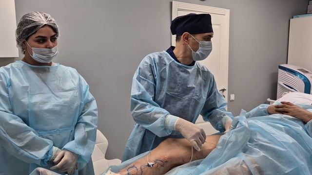 Вот как проходит лазерная операция на венах. Избавляем от варикоза. Флеболог Москва. смотреть онлайн