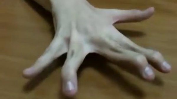 Рука монстр