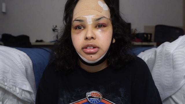 Facial feminization surgery in Colombia смотреть онлайн