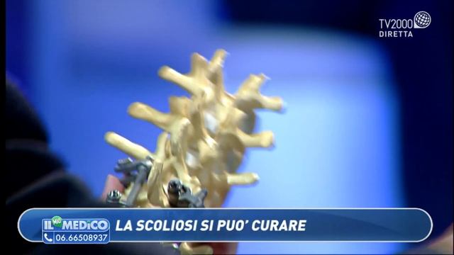 Il Mio Medico - La scoliosi si può curare смотреть онлайн