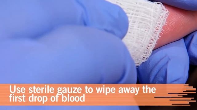 Perform a Capillary Puncture Obtain a Blood Sample by Capillary Puncture смотреть онлайн