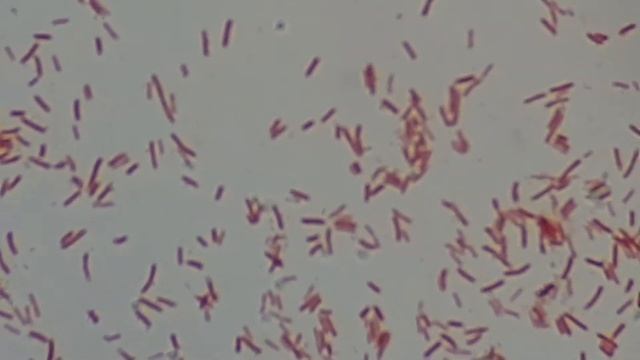 Klebsiella Pneumoniae In Gram Staining