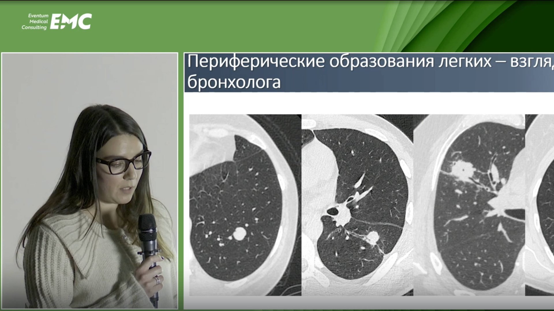 4 Чесалина Я.О. Навигационная бронхоскопия: высокая четкость, малый диаметр, оптическая биопсия.