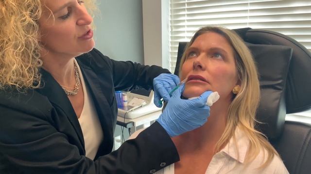 Lip Flip With Botox смотреть онлайн