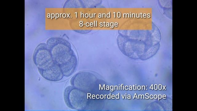 Sea Urchin Fertilization смотреть онлайн