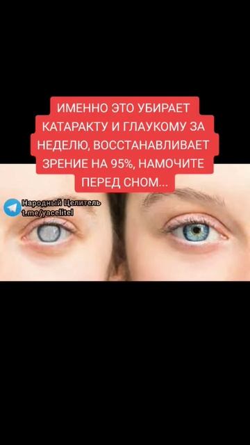 именно это убирает катаракту и ГЛАУКОМУ ЗА НЕДЕЛЮ #здоровье #зож #народнаямедицина #безтаблеток смотреть онлайн