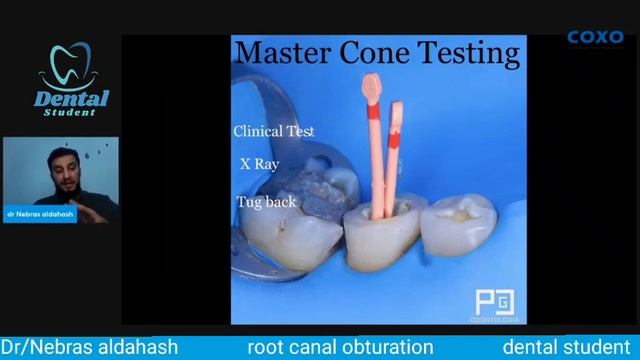 Root Canal Obturation _ 3D Obturation смотреть онлайн