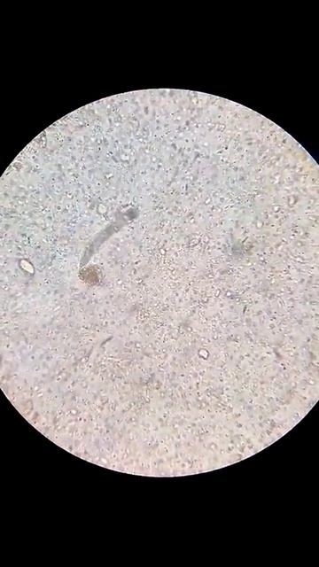 parasito ancylostoma смотреть онлайн