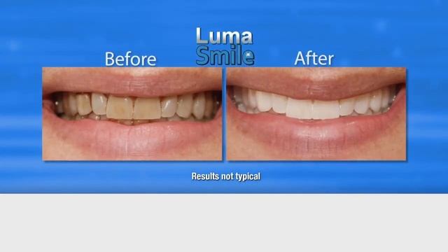 Luma Smile смотреть онлайн