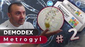 Метрогил против клеща | Угревая Железница Demodex #2