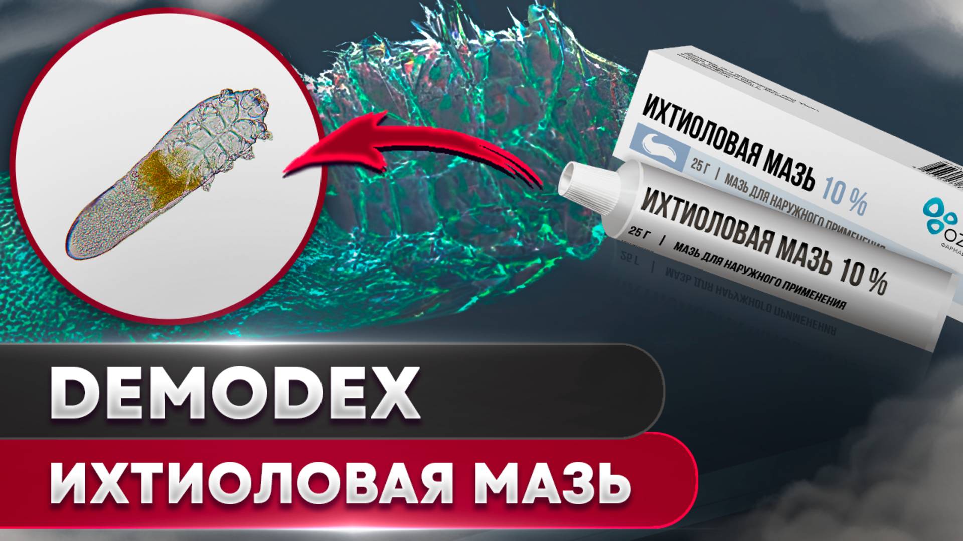 Ихтиоловая мазь против клеща | Угревая Железница Demodex