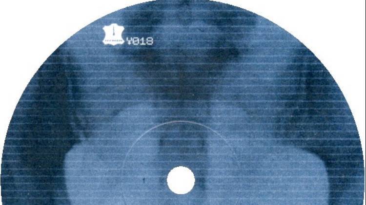 Somatic Responses - Open Window смотреть онлайн