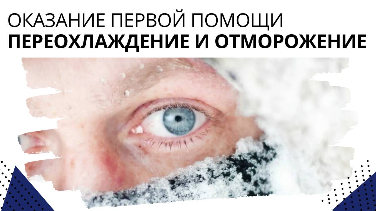 Оказание первой помощи. Переохлаждение и отморожение