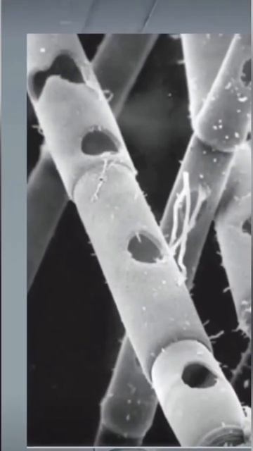 Амёба Вампир