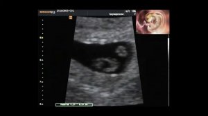 узи на 6 7 неделе беременности