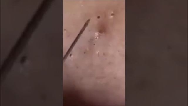 Чистка лица. смотреть онлайн