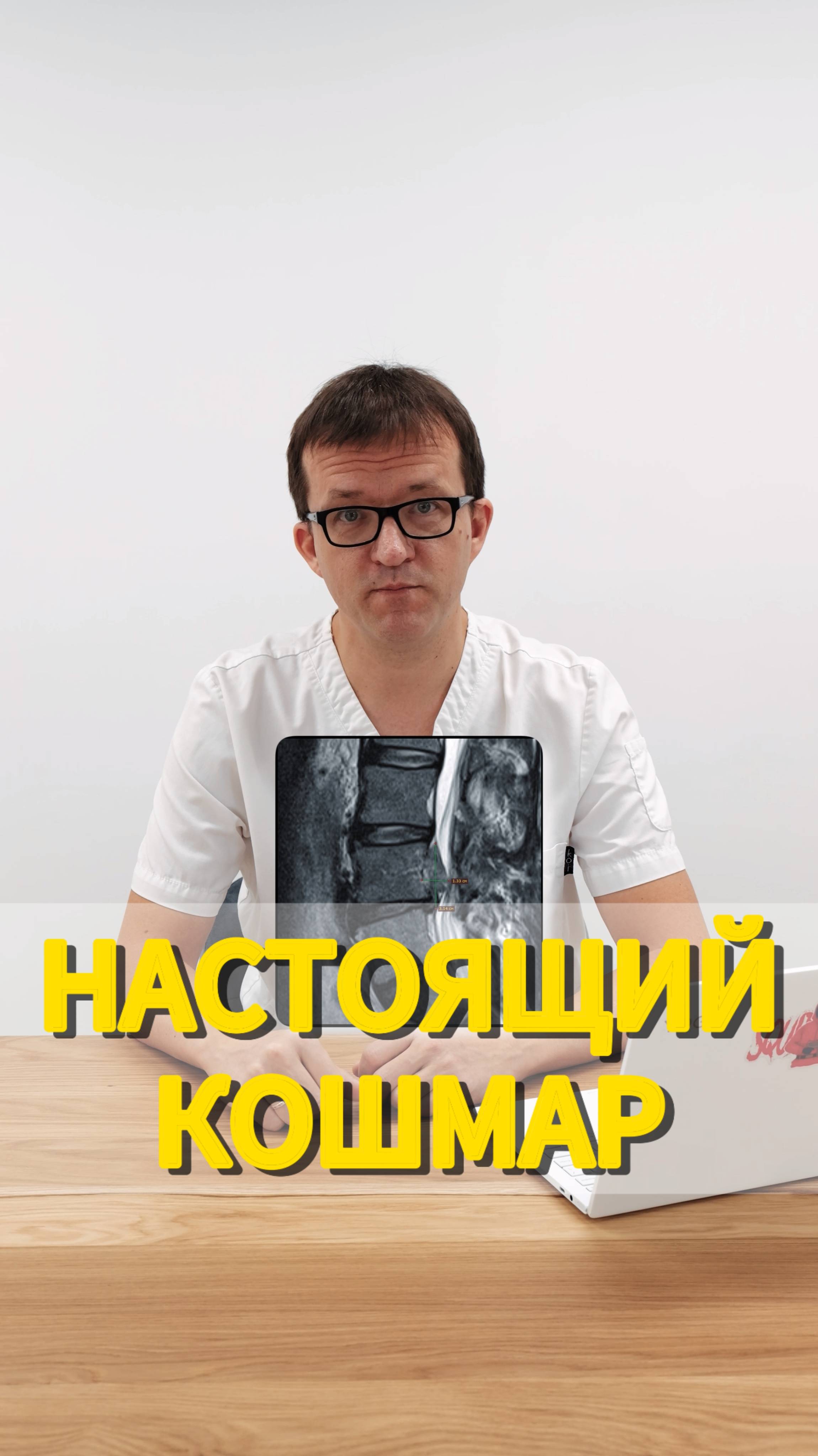 Секвестрированная грыжа