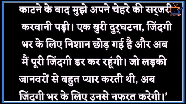 Sana Makbul Revealed That she had to undergo surgery after This accident ! смотреть онлайн