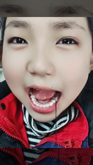 Baby Teeth Falling Out #shorts смотреть онлайн