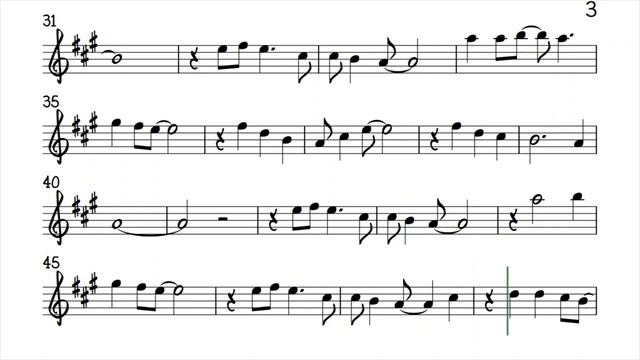 Where Have All The Flowers Gone Alto Sax Sheet Music Backing Track Play Along Partitura ( 720 X 1280 смотреть онлайн