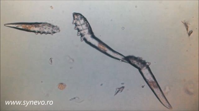 Paraziţi: Demodex folliculorul şi brevis смотреть онлайн