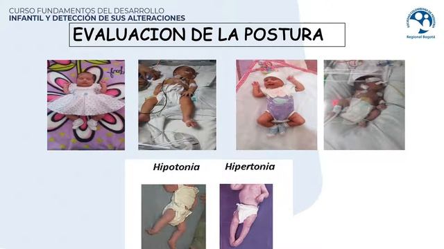 EXAMEN NEUROLOGICO EN LA EVALUACION DEL NEURODESARROLLO смотреть онлайн
